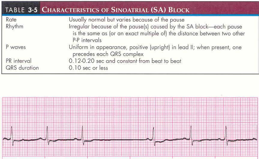 sinus-mechanisms